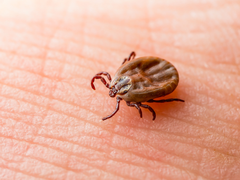 Lyme Disease Infected Tick Insect Crawling on Skin. Encephalitis Virus or Lyme Borreliosis Disease Infectious Dermacentor Tick Arachnid Parasite Macro.
